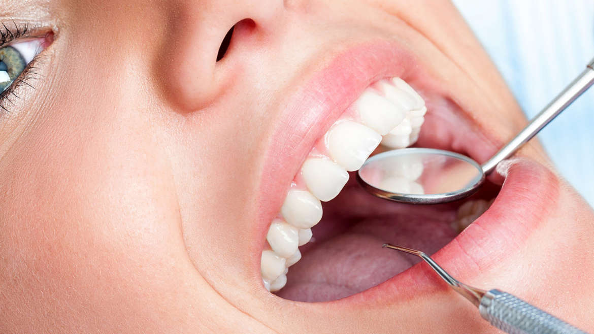 Konzervativna stomatologija i endodoncija – liječenje karijesa i zubnog živca